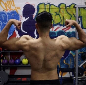 Personal trainer finally finds salvation for his psoriasis with a serum made with plant roots