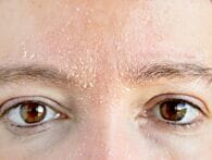 Is skin microdosing the key to managing eczema?