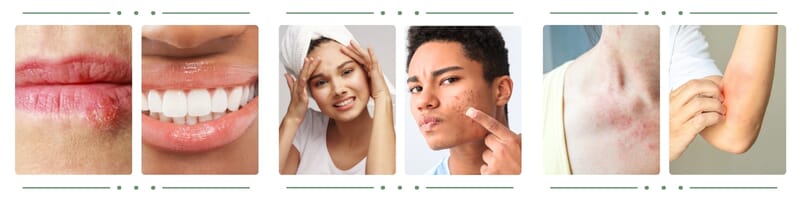 Before and After Kalme Skin Care Routine